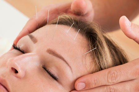 Facial Rejuvination Acupuncture
