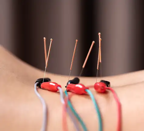 Pelvic Floor Acupuncture